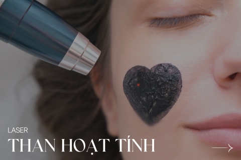 Laser than hoạt tính